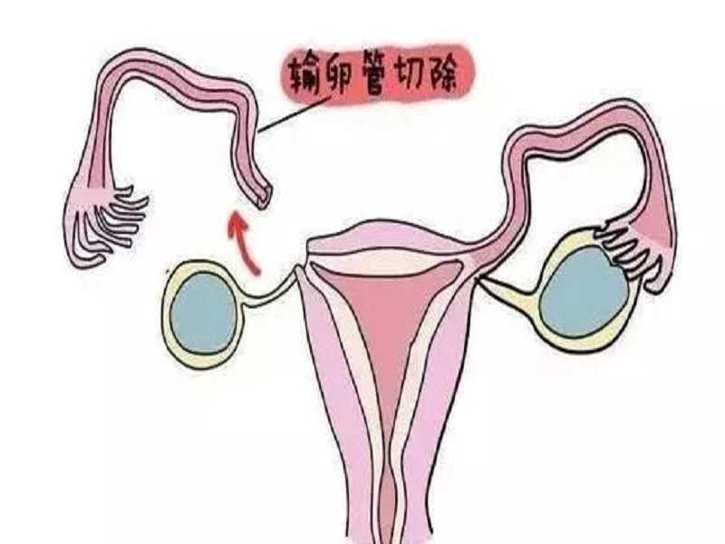 广州医院供卵试管婴儿多少钱？